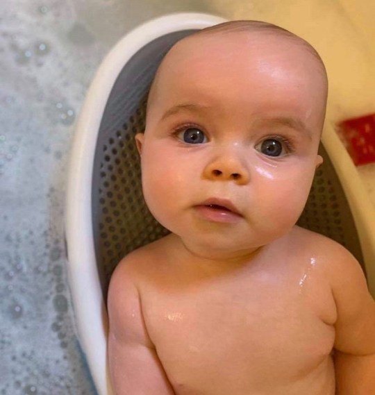 Baby born with flat head needs £4,500 helmet to save him from skull surgery London Daily