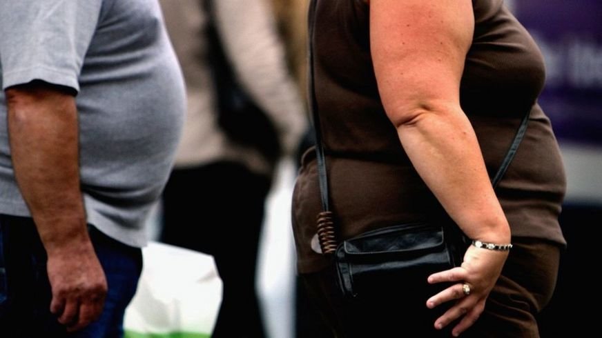 Obesity increases risks from Covid-19, experts say