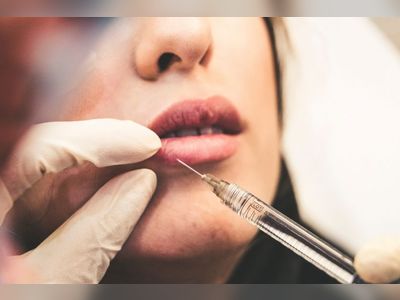 Britain urged to ban lip fillers and Botox for teenagers