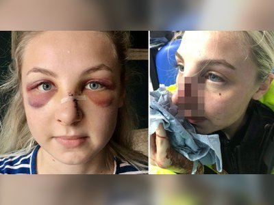 Policewoman needed 17 stitches after boy, 16, punched her as she handcuffed him