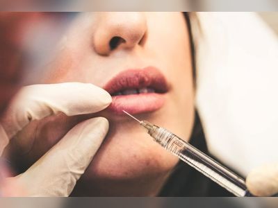 8 Facts You Need to Know Before Getting Botox