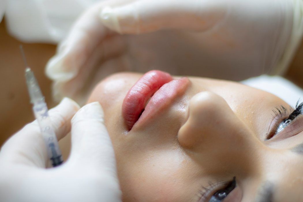 What Are Dermal Fillers and Do I Need Them?