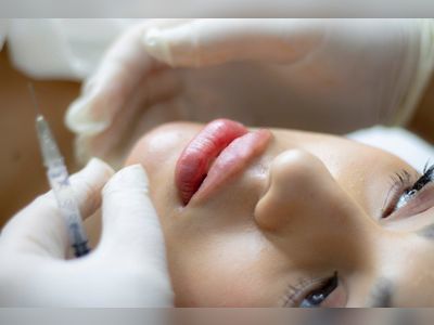 What Are Dermal Fillers and Do I Need Them?