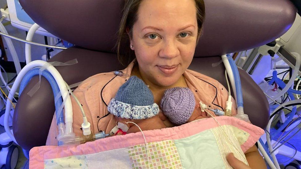 Derbyshire twins thought to be UK's most premature to survive