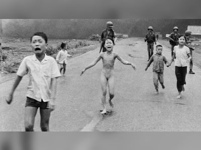 Vietnam 'Napalm Girl' receives final skin treatment in Florida 50 years after iconic image