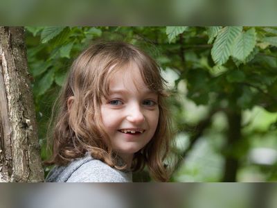 Dravet syndrome Devon girl, resuscitated 100 times