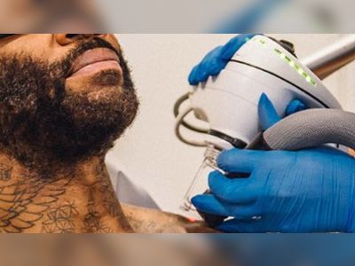 Tattoo removal specialist Naama inks £11m funding from blue-chip backers