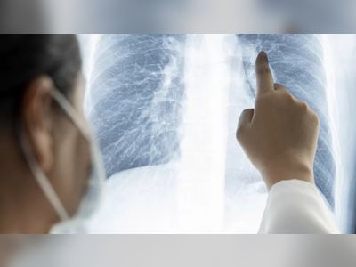 Study reveals cancer’s ‘infinite’ ability to evolve