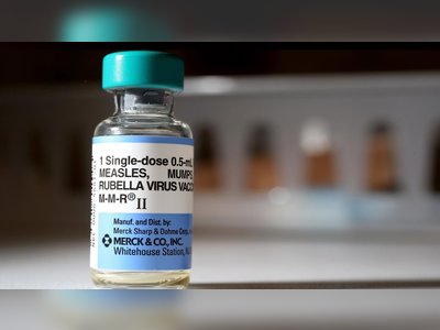 Wales' Chief Medical Officer calls for immediate measles vaccination for children